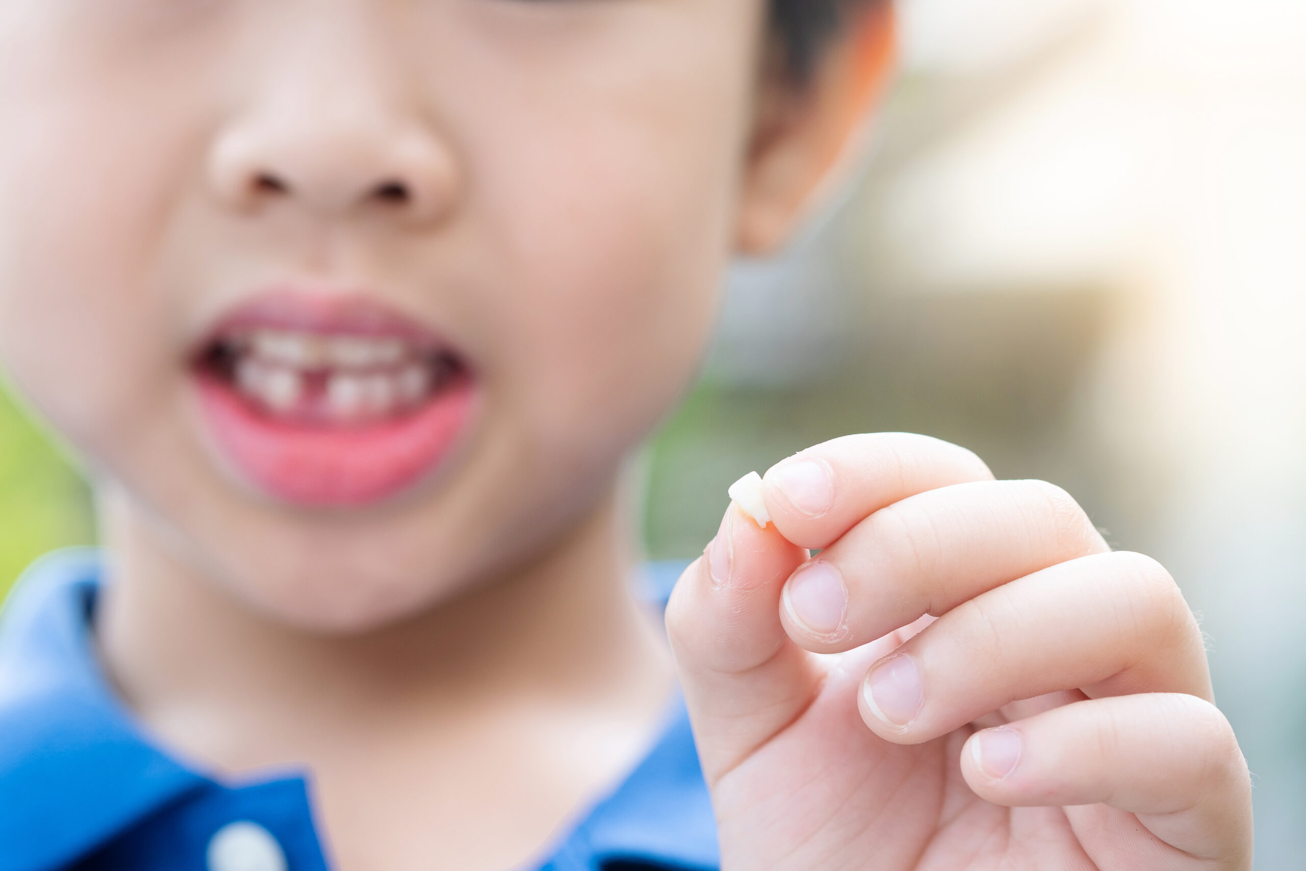 Asia little young boy showing his first lost milk-tooth in his hand with copy space. Medical and health care concept.