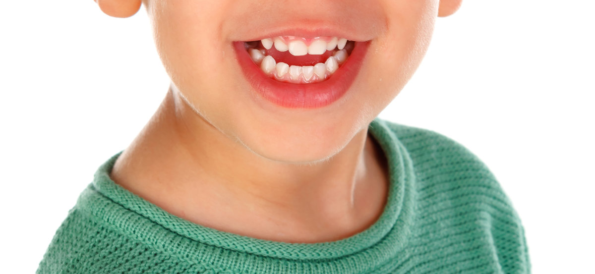 Teeth of a little child close up