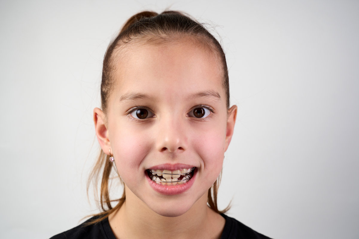 Little girl with teeth retainers looking at camera, close-up. Child with orthodontic plate or dental braces in her mouth. Children's dentistry